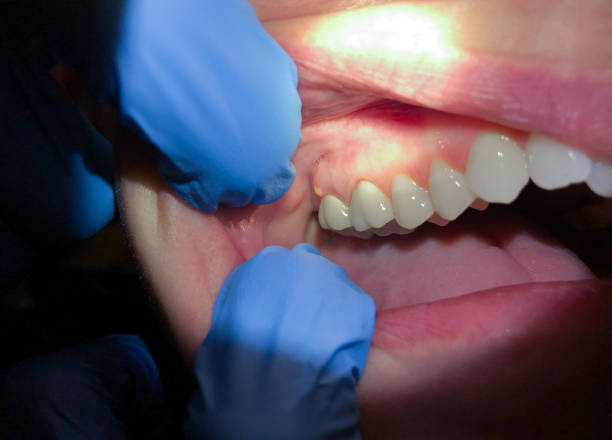 Best Emergency Dental Surgery in Goldstream, AK