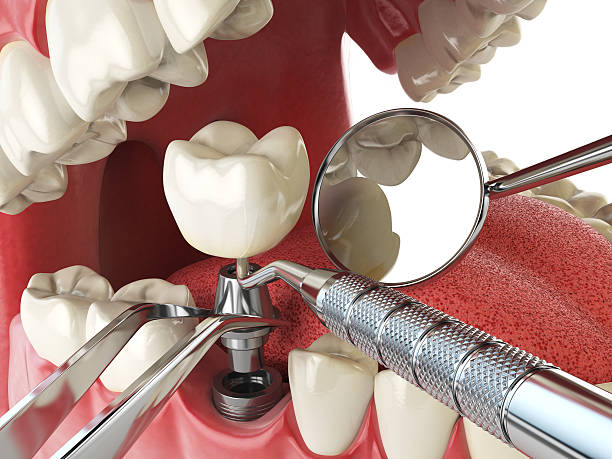 Best Emergency Broken Tooth Repair in Goldstream, AK