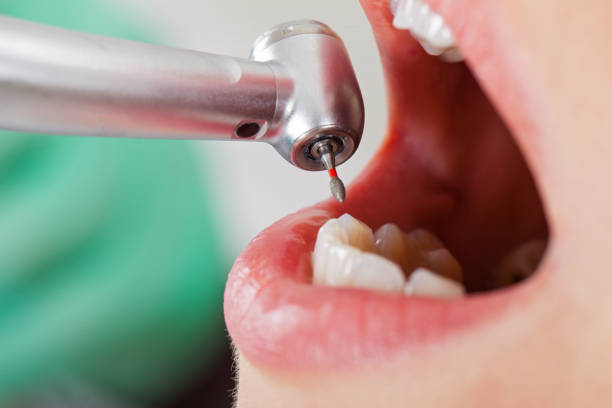 Best Walk-In Emergency Dentist in Goldstream, AK